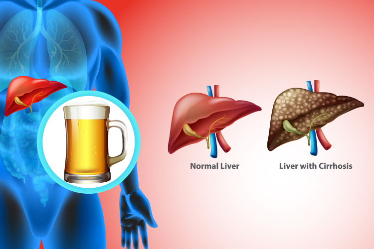 Sleep Disorder treatment in Greater Noida